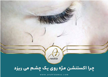 چرا اکستنشن مژه روی یک چشم می ریزد