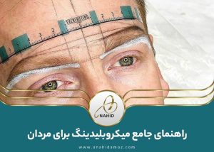 میکروبلیدینگ برای مردان: آیا این روش مناسب مردان هست؟
