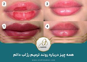 همه چیز درباره روند ترمیم رژ لب دائم