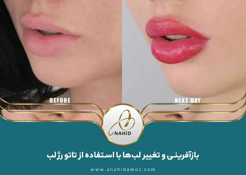 بازآفرینی و تغییر لب‌ها با استفاده از تاتو رژ لب و فناوری خنثی‌سازی تیرگی لب
