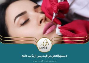 مراقبت های بعد از رژ لب دائم