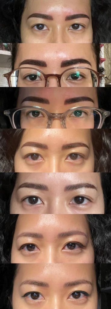 Day 0 to day 12 progress micro